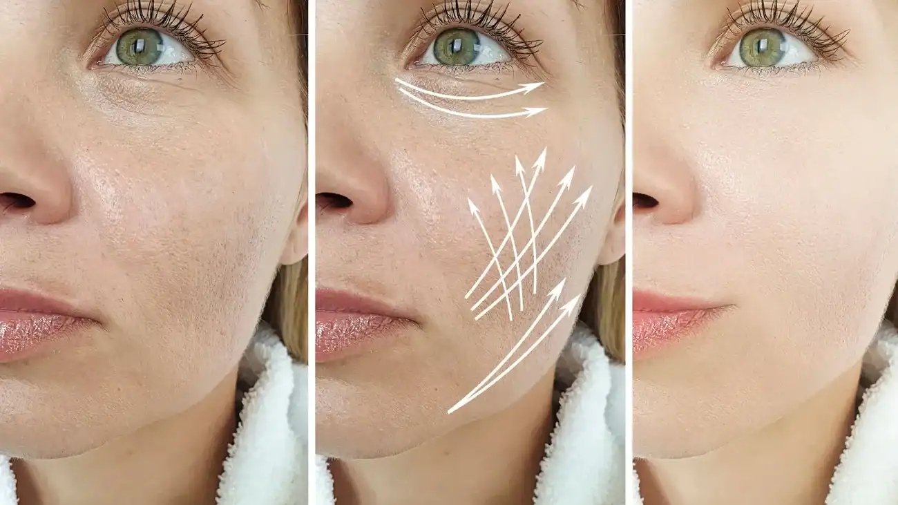 Can One Treatment Really Tackle More Than One Skin Concern Haslemere?