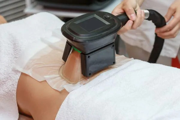 Image of person having fat freezing treatment to help weight gain Haslemere
