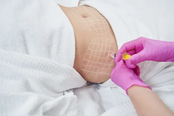 image of fat dissolving injections on love handles to help combat weight gain Haslemere
