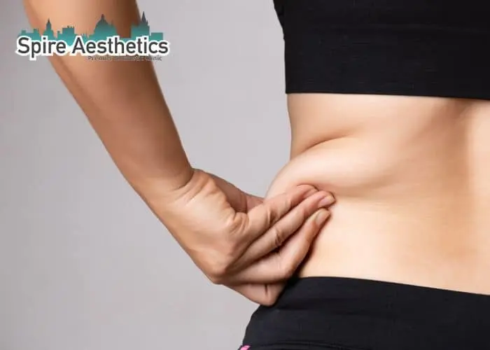 Image of woman pinching fat on their hips Haslemere. Fat Freezing treatment