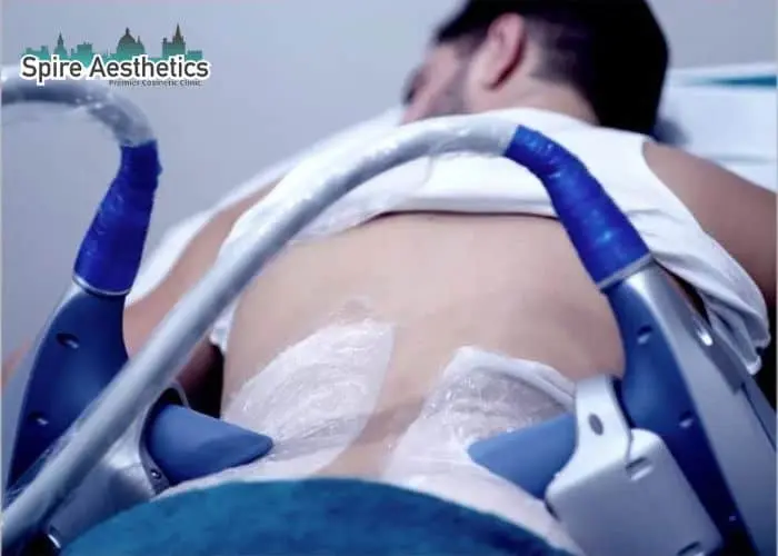 Man having fat freezing treatment done on love handles before a competitions Haslemere to create a sculpted look.