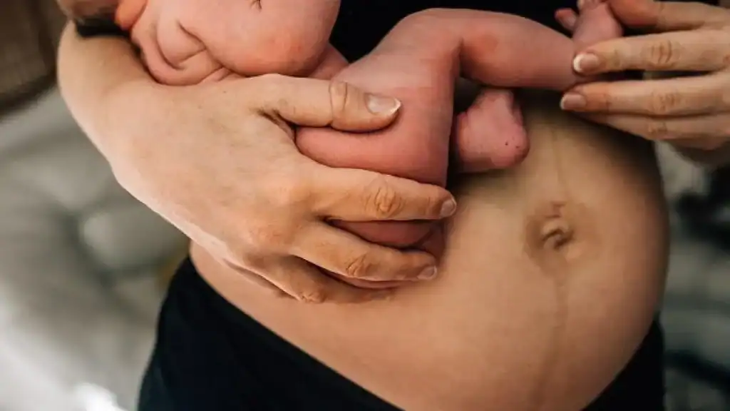Why Is My Stomach Still Big After Pregnancy Haslemere?